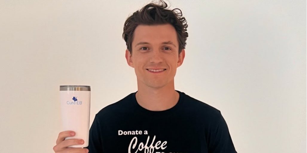 Том Холланд травмировался на&nbsp;съемках фильма Человек-паук (Фото: tomholland2013/Instagram)